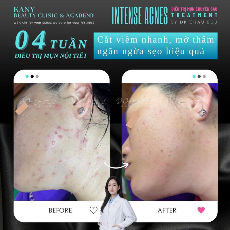 KANY Beauty Clinic & Academy