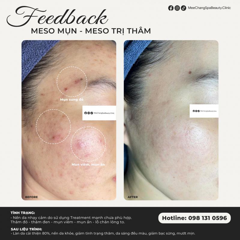 MeeChang Spa Beauty & Clinic