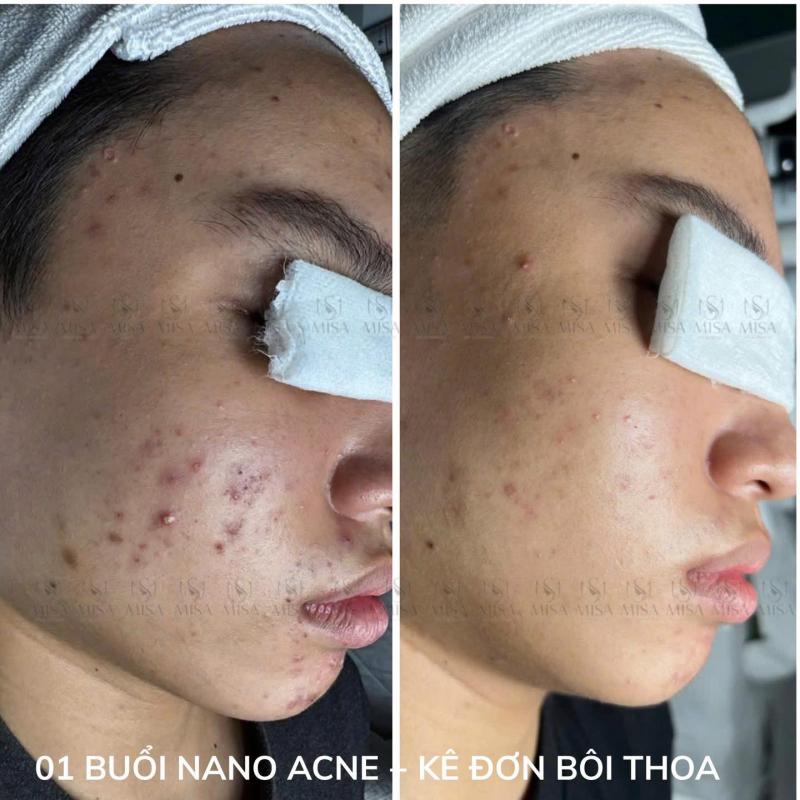 MiSa Spa - Beauty & Clinic