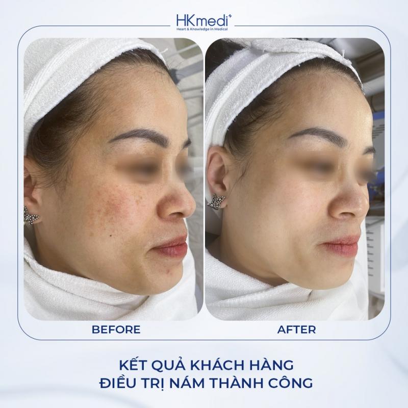 Phòng Khám Chuyên Khoa Da Liễu HKmedi