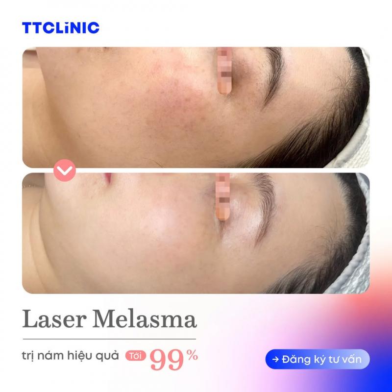 Phòng Khám Chuyên Khoa Da Liễu Thẩm Mỹ - TTCLiNIC