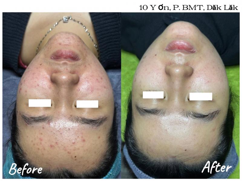 Phòng khám da liễu NU