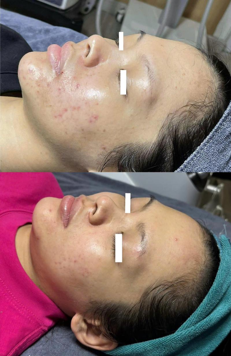 Phòng khám da liễu NU