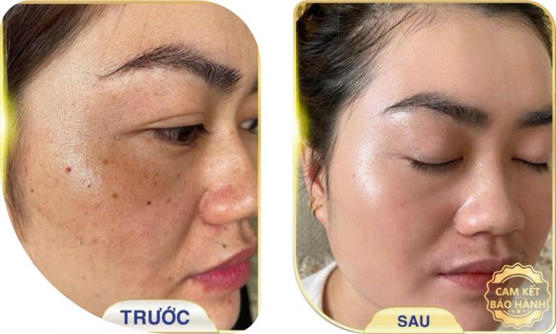 Spa Hải Yến