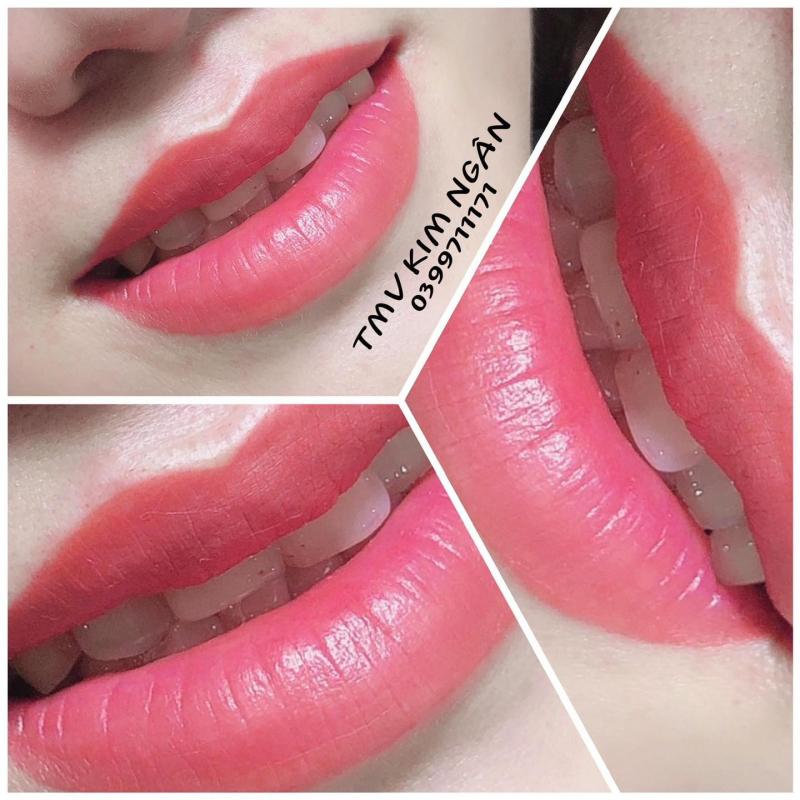 Thẩm Mỹ Viện KIM NGÂN