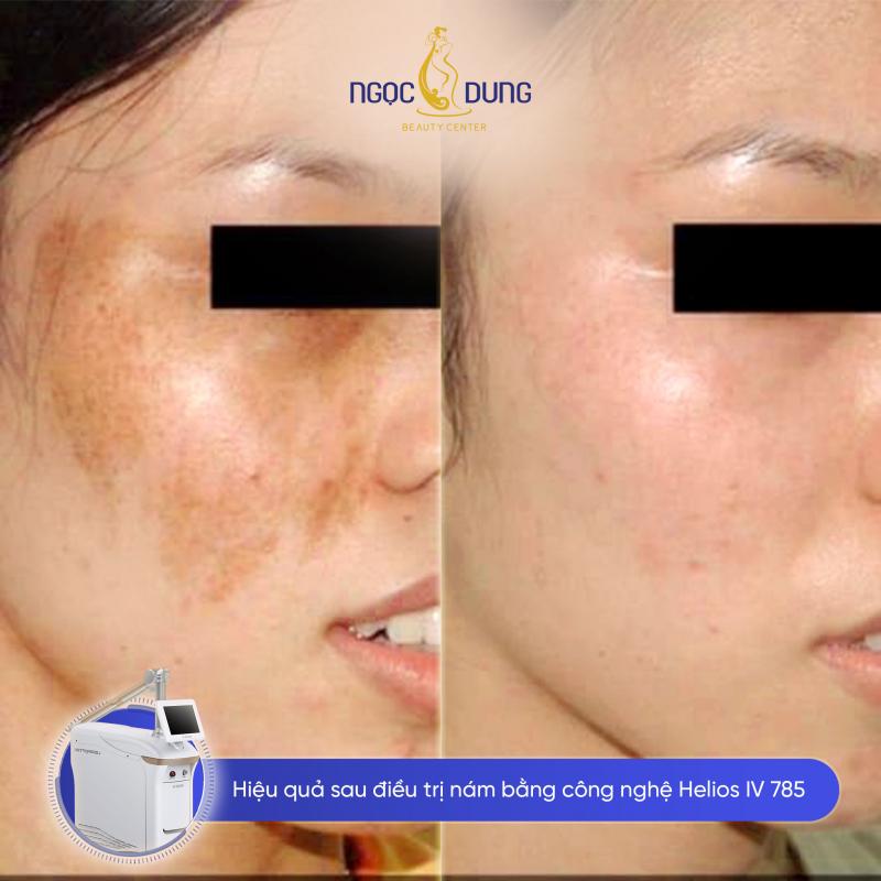 Ngọc Dung luôn áp dụng công nghệ mới nhất