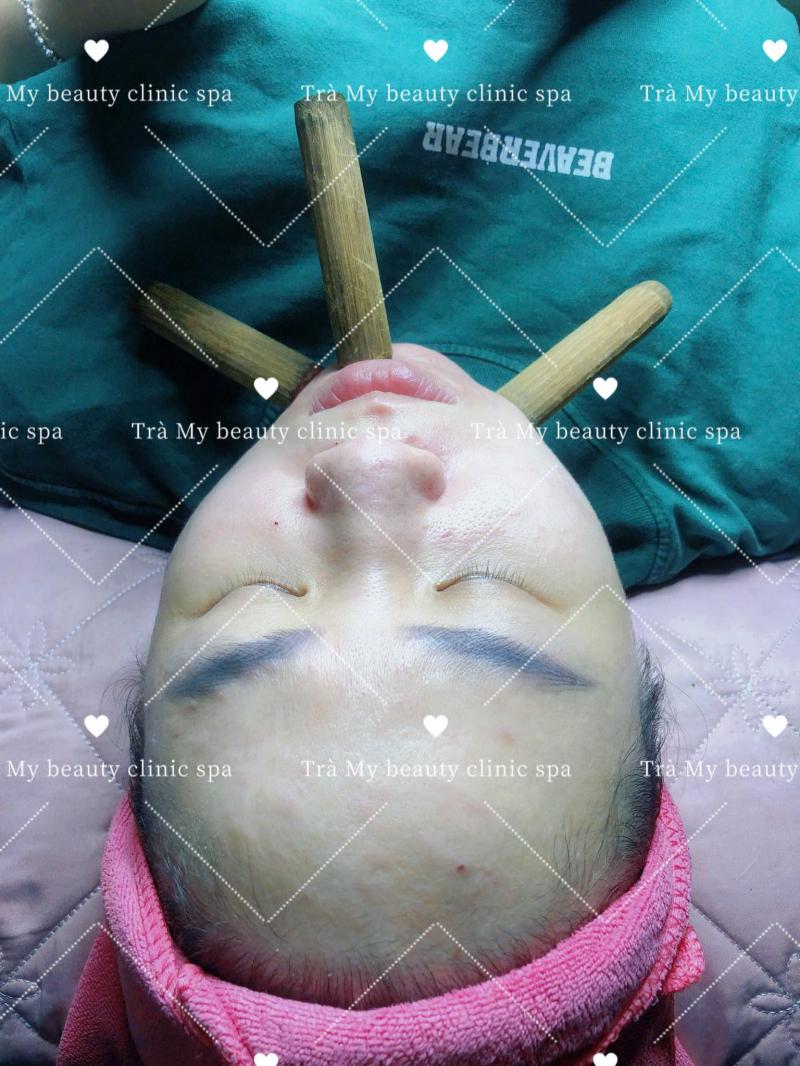 Trà My - Beauty Clinic Spa